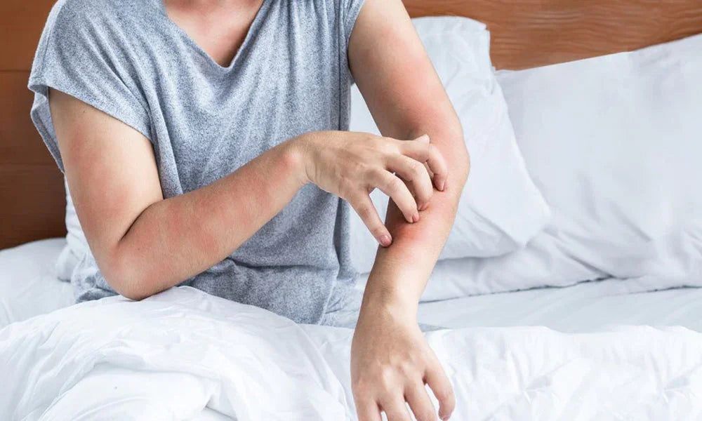 Pest Control in Hotels: Essential Strategies for Maintaining Cleanliness and Guest Safety
