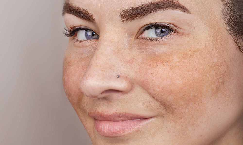 Why Your Pigmentation Isn’t Fading: Common Mistakes and Fixes