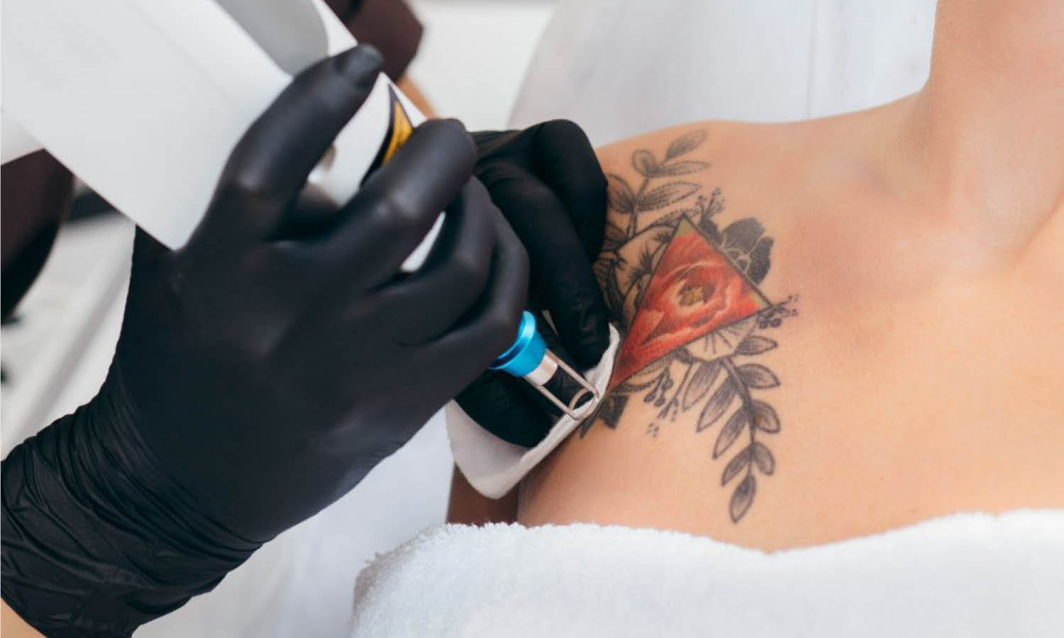 Breaking Down Laser Tattoo Removal Cost