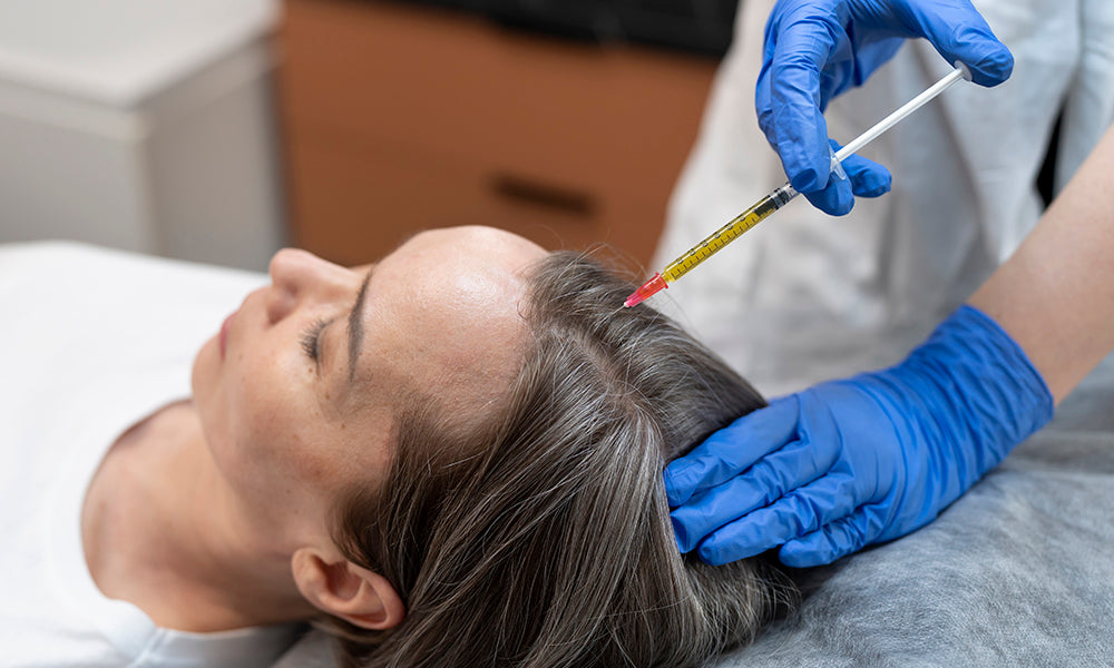 Harnessing PRP Therapy: A New Era in Hair Restoration