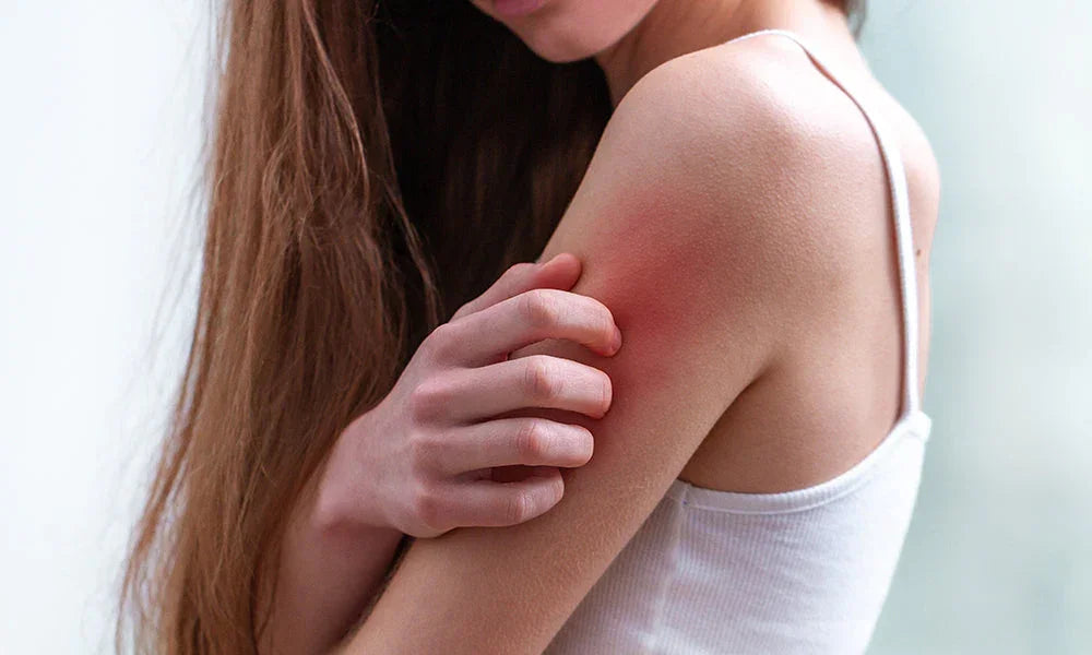 How to Fight Inflammation Naturally