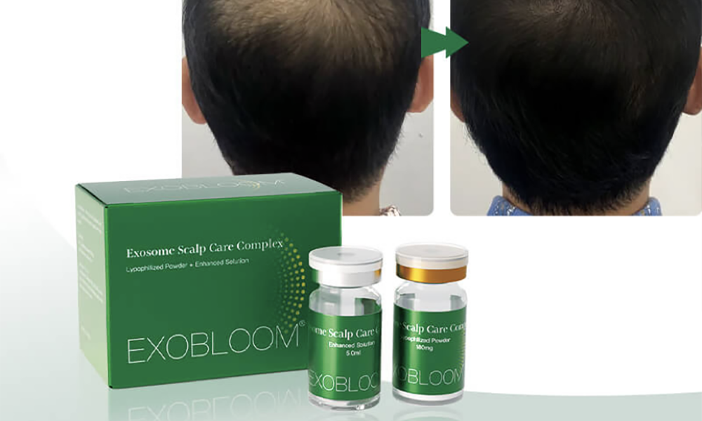 Exosome Hair Therapy: Advanced Solution for Hair Loss & Regrowth